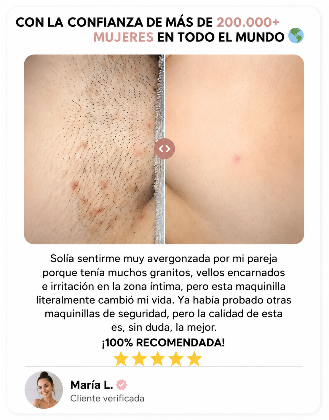 SKINRAZR™ — Rasuradora de precisión para una piel suave